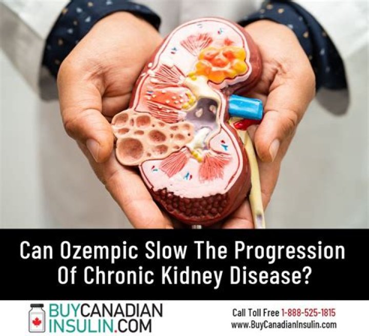 Can Ozempic Protect the Kidneys for People with Type 2 Diabetes