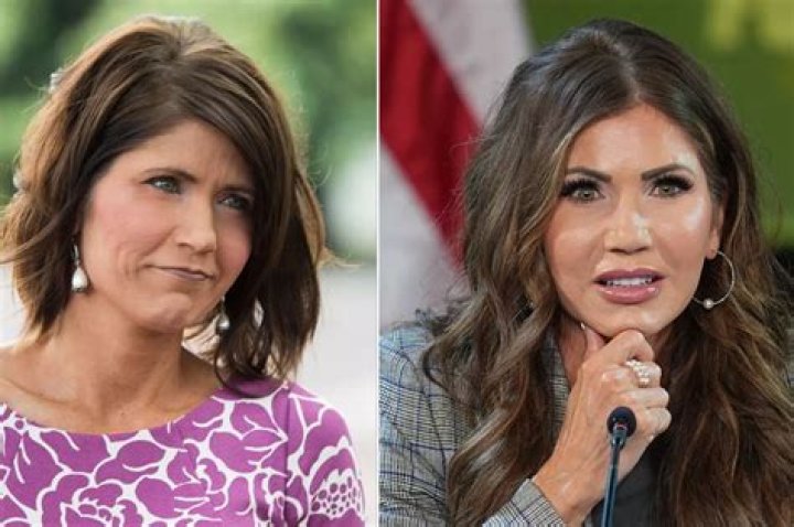 The Ultimate Guide To Kristi Noem's Plastic Surgery Journey