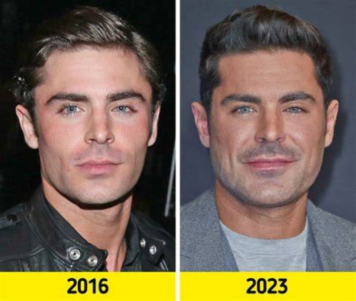 Why Zac Efron's Famous Face Looks Different Nowadays